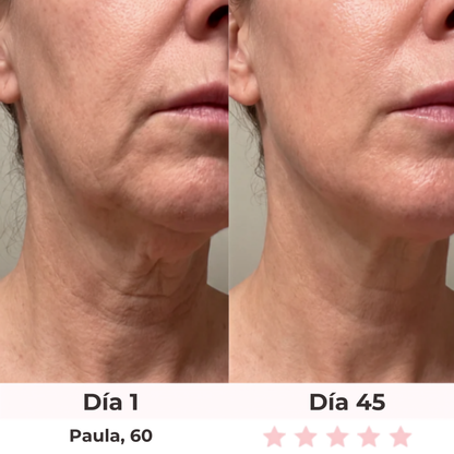 Esculptor Facial Lift Belume