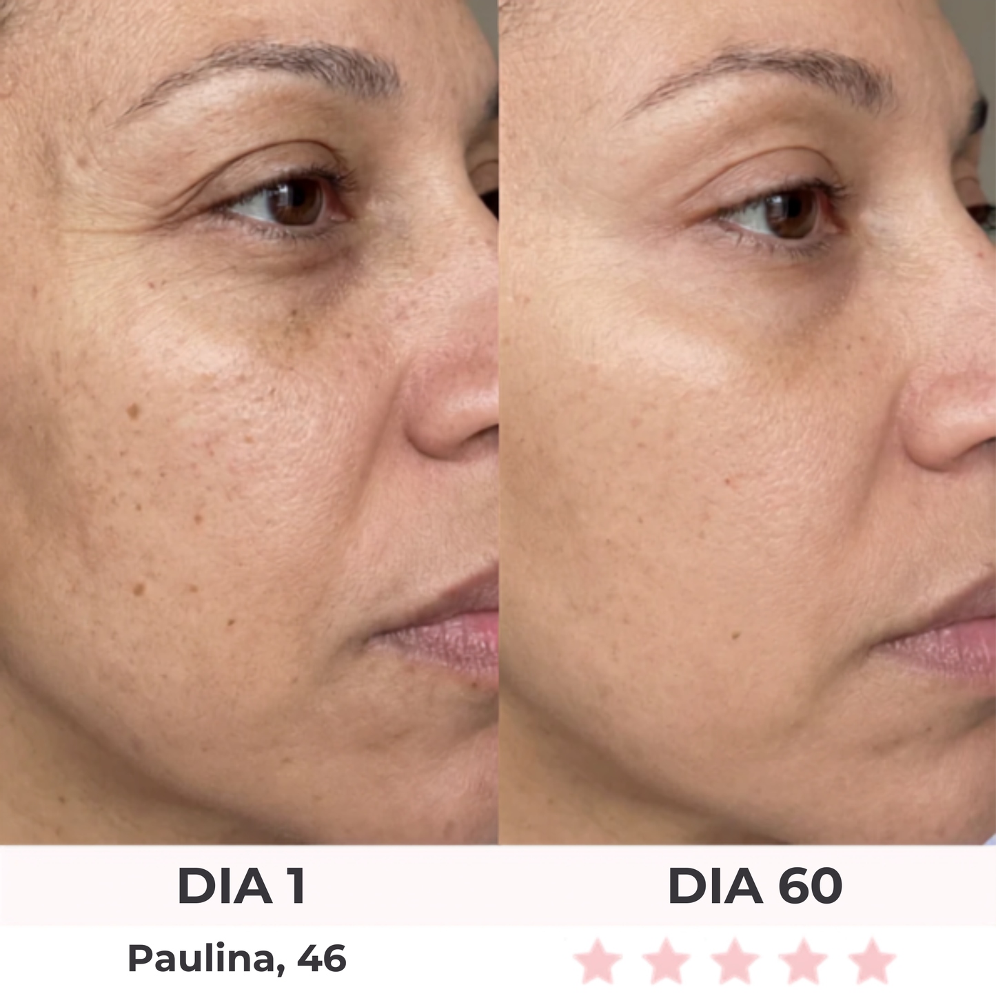 Anteojos Red Light Belume®