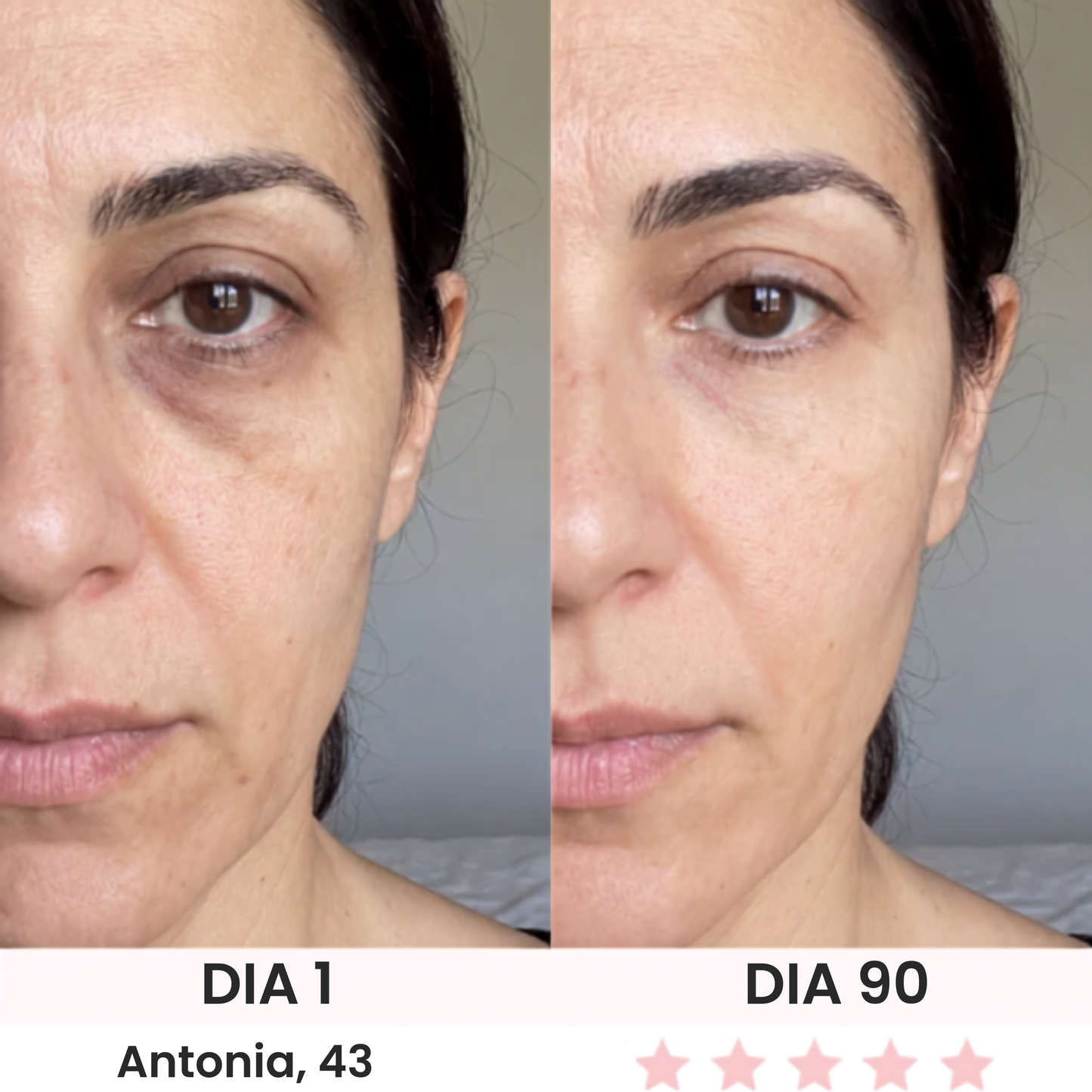 Anteojos Red Light Belume®