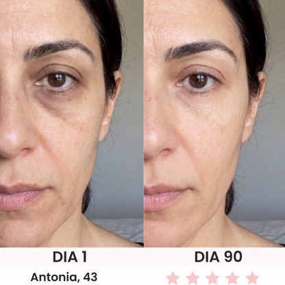 Anteojos Red Light Belume®